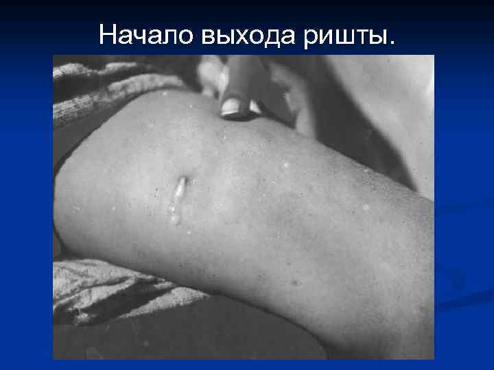 Начало выхода ришты. 