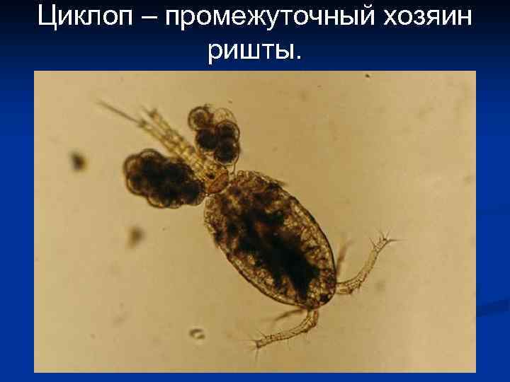 Циклоп – промежуточный хозяин ришты. 