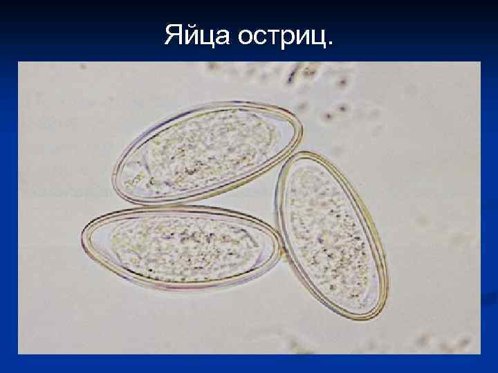 Яйца остриц. 