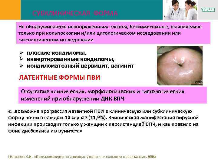 СУБКЛИНИЧЕСКАЯ ФОРМА Не обнаруживаются невооруженным глазом, бессимптомные, выявляемые только при кольпоскопии и/или цитологическом исследовании