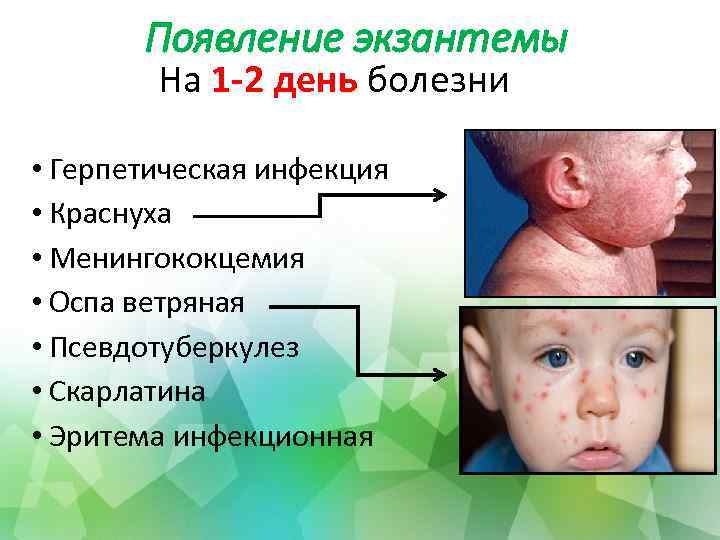 Появление экзантемы На 1 -2 день болезни • Герпетическая инфекция • Краснуха • Менингококцемия