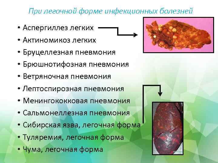 При легочной форме инфекционных болезней • Аспергиллез легких • Актиномикоз легких • Бруцеллезная пневмония