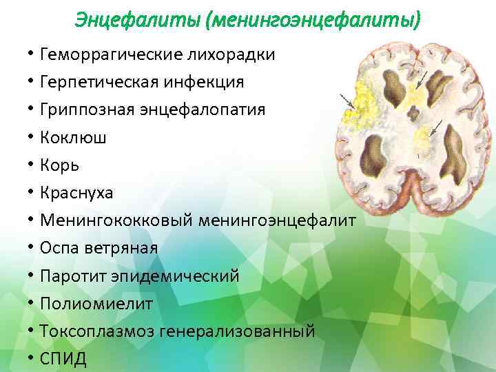 Энцефалиты (менингоэнцефалиты) • Геморрагические лихорадки • Герпетическая инфекция • Гриппозная энцефалопатия • Коклюш •