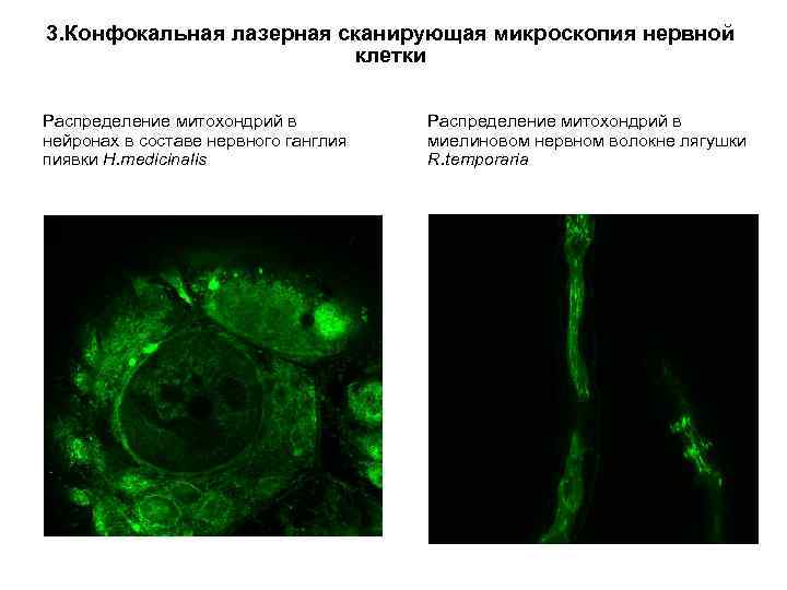 3. Конфокальная лазерная сканирующая микроскопия нервной клетки Распределение митохондрий в нейронах в составе нервного