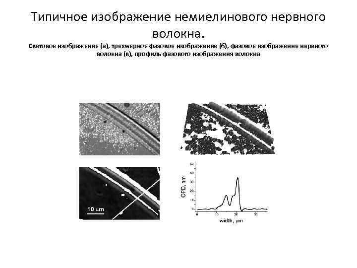 Типичное изображение немиелинового нервного волокна. Световое изображение (а), трехмерное фазовое изображение (б), фазовое изображение