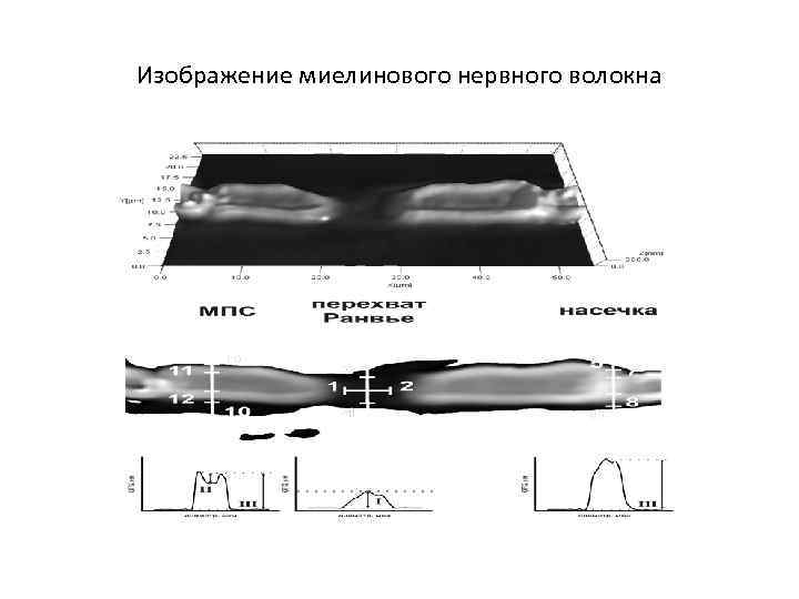 Изображение миелинового нервного волокна 