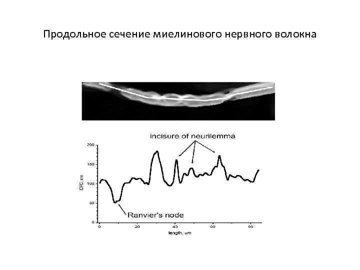 Продольное сечение миелинового нервного волокна 