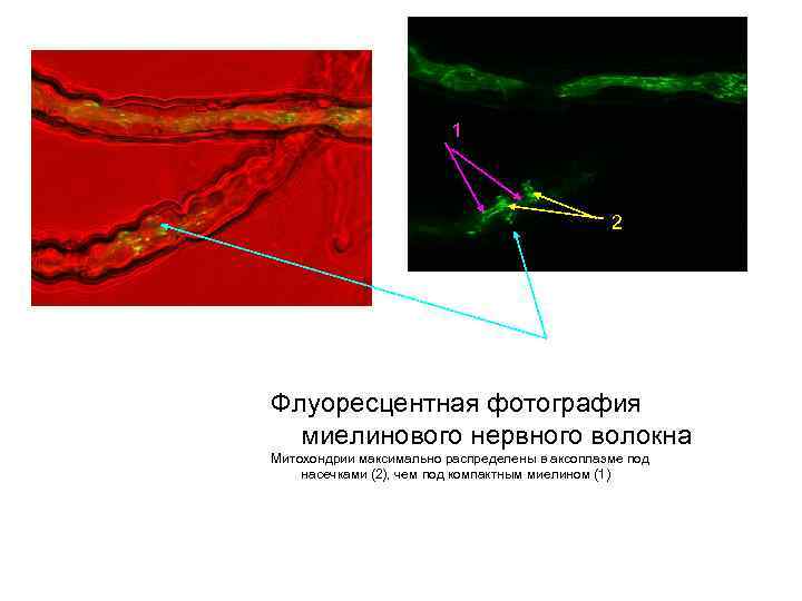 1 2 Флуоресцентная фотография миелинового нервного волокна Митохондрии максимально распределены в аксоплазме под насечками
