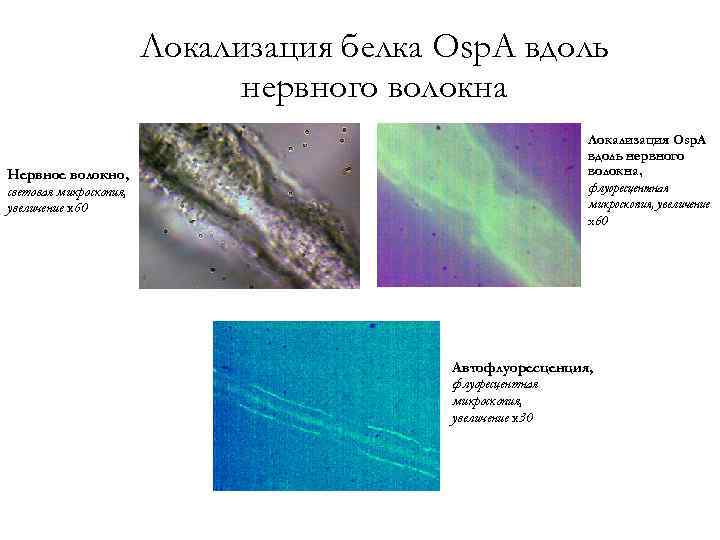 Локализация белка Osp. A вдоль нервного волокна Нервное волокно, световая микроскопия, увеличение x 60