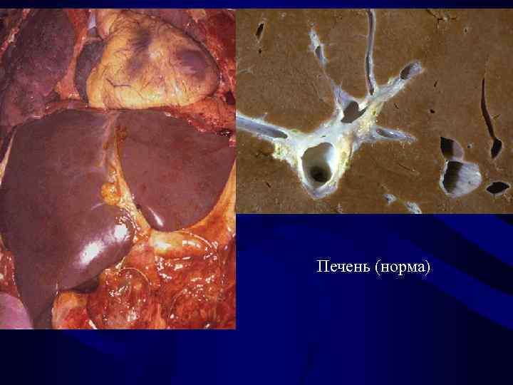 Печень (норма) 
