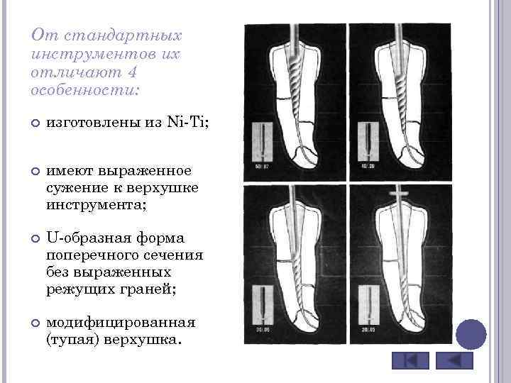 От стандартных инструментов их отличают 4 особенности: изготовлены из Ni-Ti; имеют выраженное сужение к