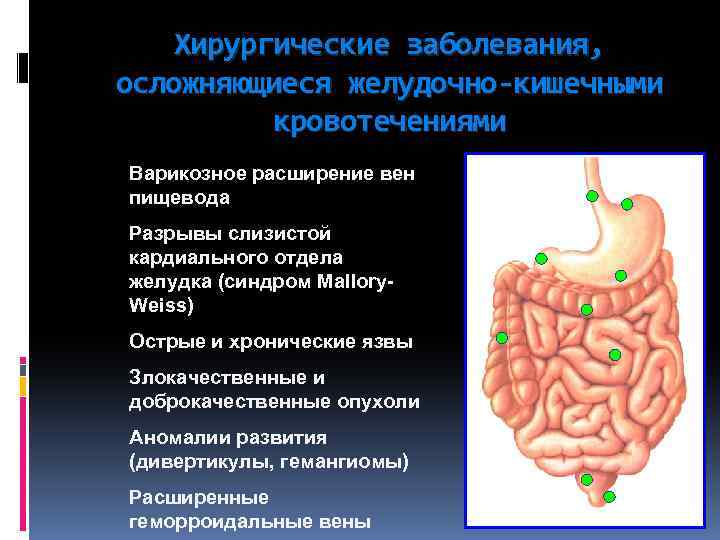 Хирургические заболевания, осложняющиеся желудочно-кишечными кровотечениями Варикозное расширение вен пищевода Разрывы слизистой кардиального отдела желудка