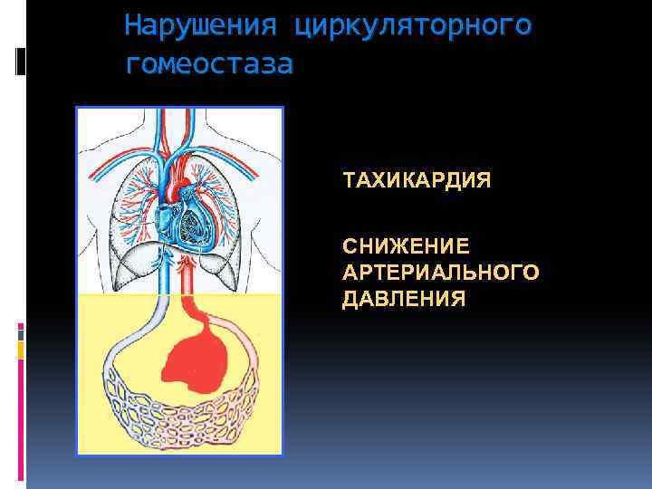 Нарушения циркуляторного гомеостаза ТАХИКАРДИЯ СНИЖЕНИЕ АРТЕРИАЛЬНОГО ДАВЛЕНИЯ 