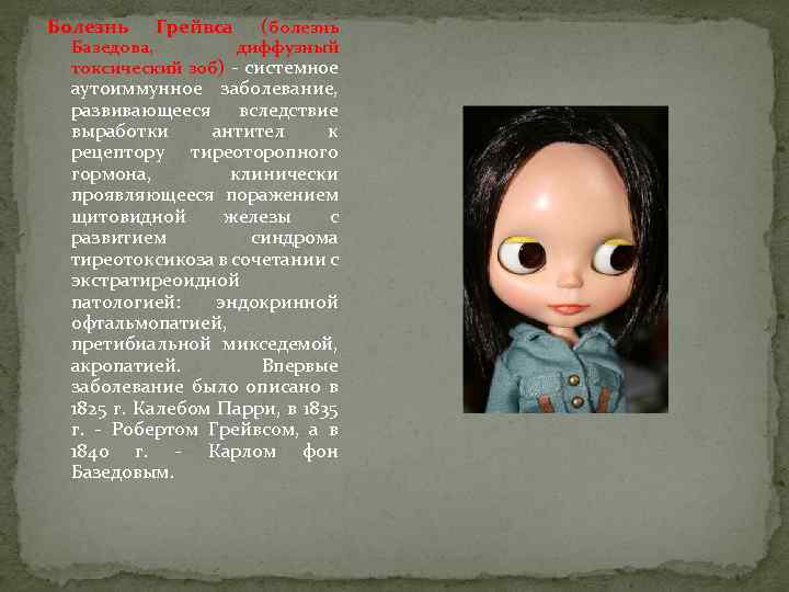 Болезнь Грейвса (болезнь Базедова, диффузный токсический зоб) - системное аутоиммунное заболевание, развивающееся вследствие выработки