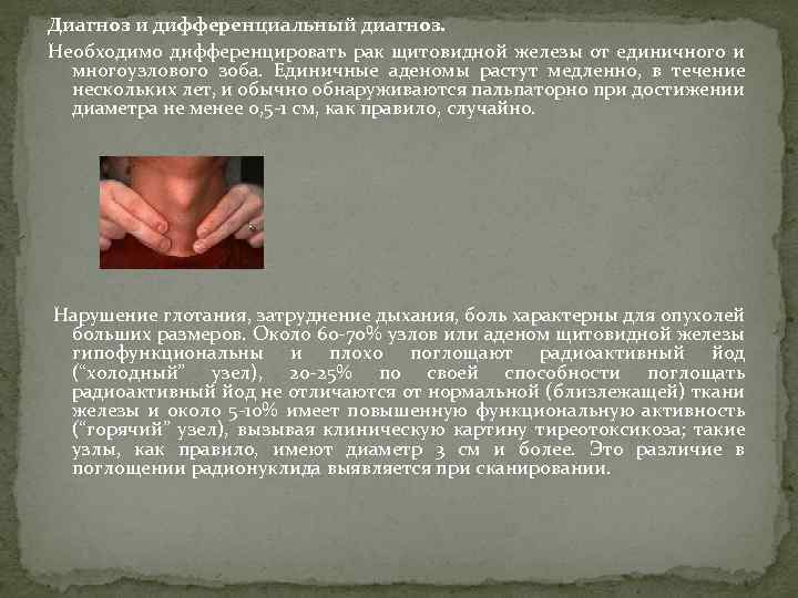 Диагноз и дифференциальный диагноз. Необходимо дифференцировать рак щитовидной железы от единичного и многоузлового зоба.