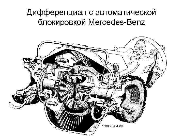 Дифференциал с автоматической блокировкой Mercedes-Benz 