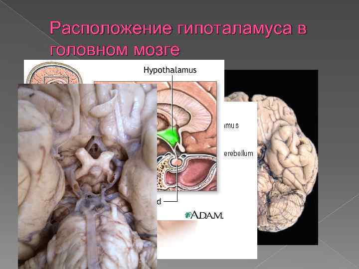 Где находится гипоталамус у человека в голове фото