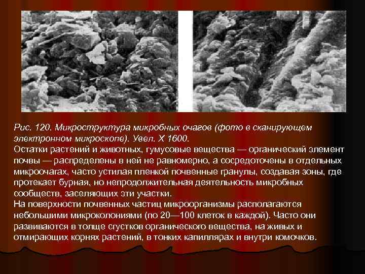 Рис. 120. Микроструктура микробных очагов (фото в сканирующем электронном микроскопе). Увел. X 1600. Остатки