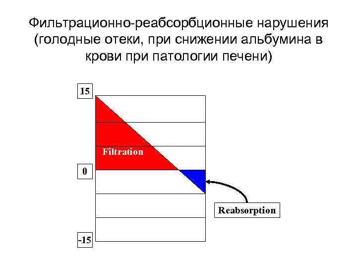 Фильтрационно-реабсорбционные нарушения (голодные отеки, при снижении альбумина в крови при патологии печени) 15 Filtration