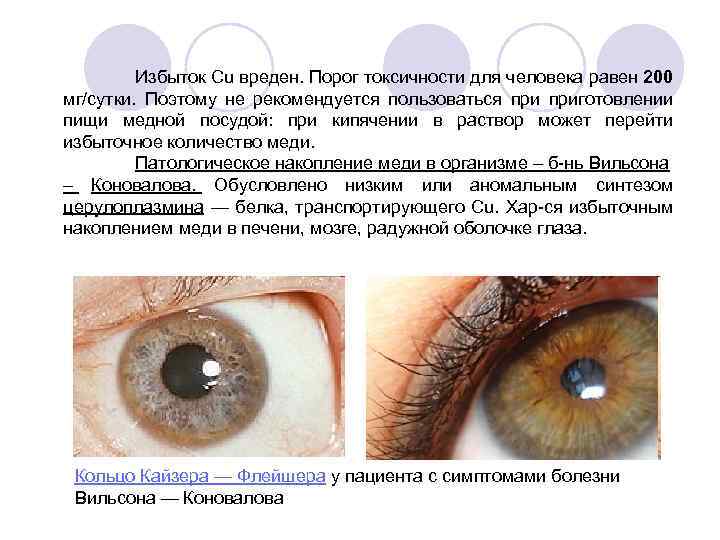 Избыток Cu вреден. Порог токсичности для человека равен 200 мг/сутки. Поэтому не рекомендуется пользоваться