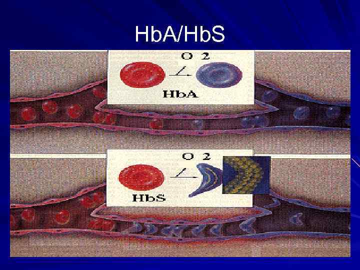 Hb. A/Hb. S 