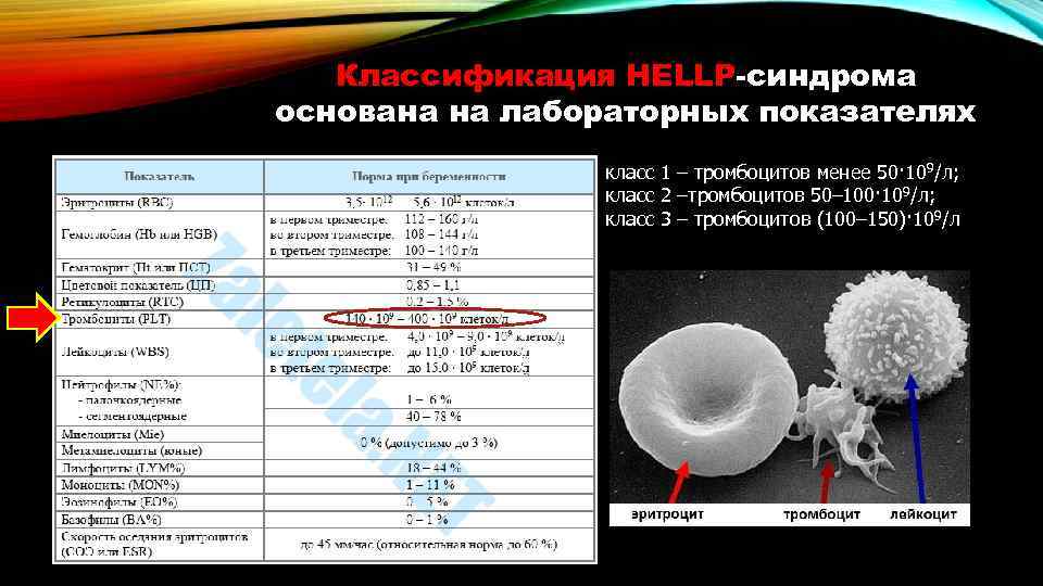 Классификация HELLP-синдрома основана на лабораторных показателях класс 1 – тромбоцитов менее 50· 109/л; класс