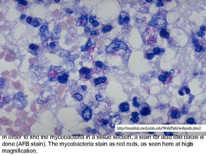 http: //medstat. med. utah. edu/Web. Path/webpath. html In order to find the mycobacteria in