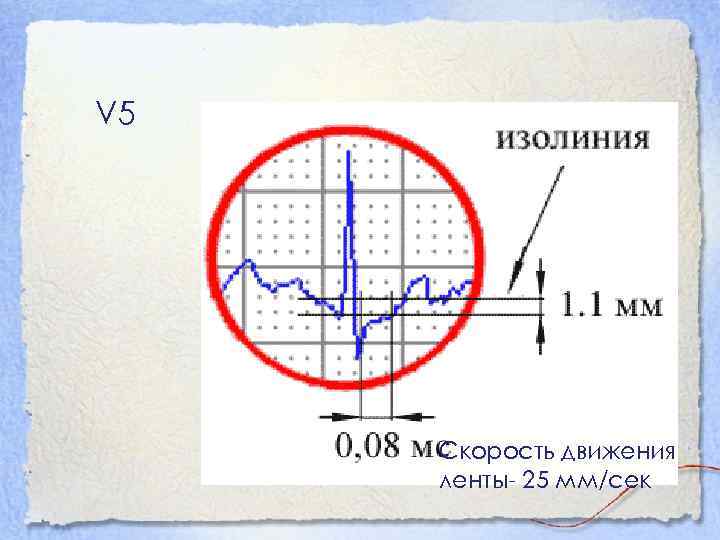 V 5 Cкорость движения ленты- 25 мм/сек 