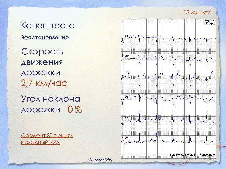 15 минута Конец теста Восстановление Скорость движения дорожки 2, 7 км/час Угол наклона дорожки