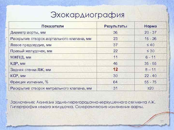 Эхокг в таблицах и схемах рыбакова