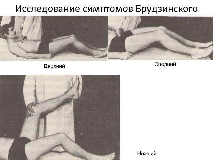 Исследование симптомов Брудзинского Верхний Средний Нижний 