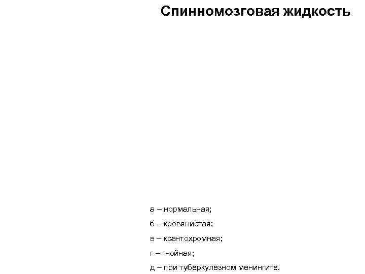 Спинномозговая жидкость а – нормальная; б – кровянистая; в – ксантохромная; г – гнойная;