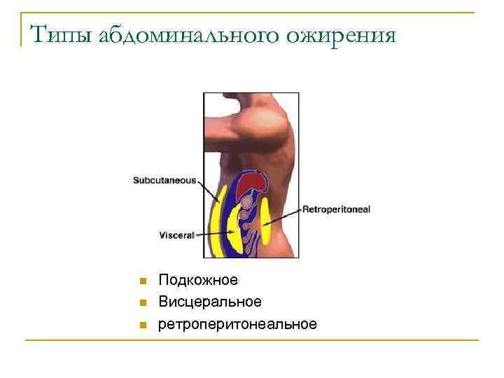 Типы абдоминального ожирения n n n Подкожное Висцеральное ретроперитонеальное 