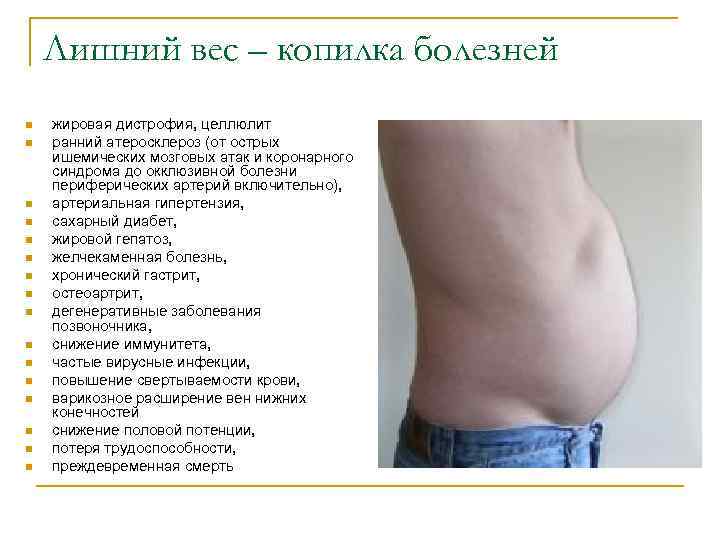 Лишний вес – копилка болезней n n n n жировая дистрофия, целлюлит ранний атеросклероз