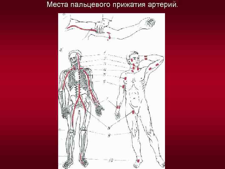 Рисунок названием артерий и костей к которым осуществляется прижатие артерии при кровотечении