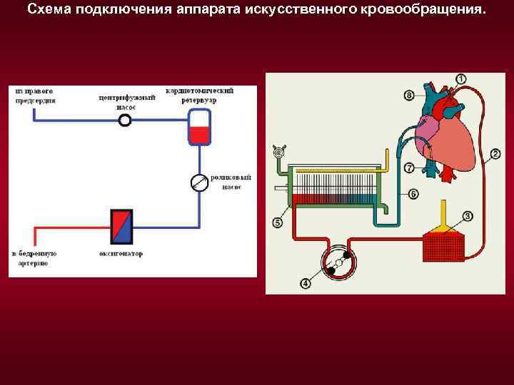 Схема искусственной