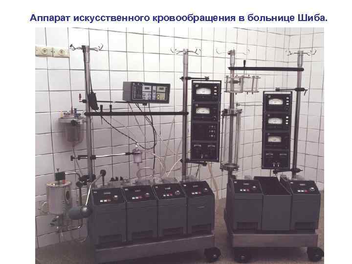 Аппарат искусственного кровообращения в больнице Шиба. 