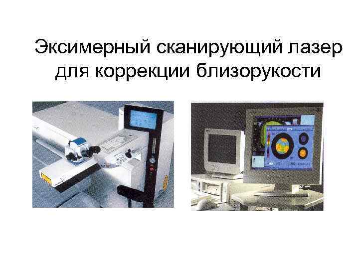 Эксимерный сканирующий лазер для коррекции близорукости 