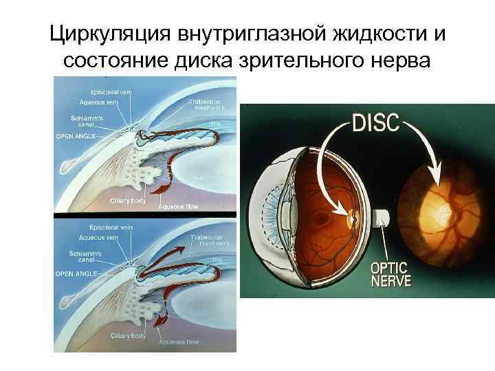 Циркуляция внутриглазной жидкости и состояние диска зрительного нерва 