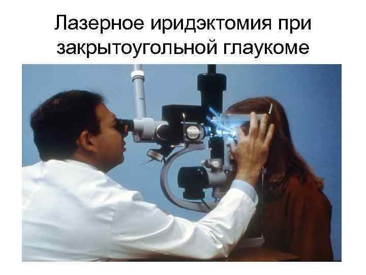 Лазерное иридэктомия при закрытоугольной глаукоме 