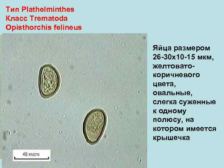 Тип Plathelminthes Класс Trematoda Opisthorchis felineus Яйца размером 26 -30 х10 -15 мкм, желтоватокоричневого