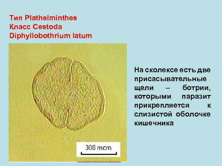 Тип Plathelminthes Класс Cestoda Diphyllobothrium latum На сколексе есть две присасывательные щели – ботрии,