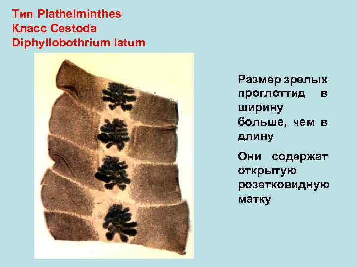 Тип Plathelminthes Класс Cestoda Diphyllobothrium latum Размер зрелых проглоттид в ширину больше, чем в