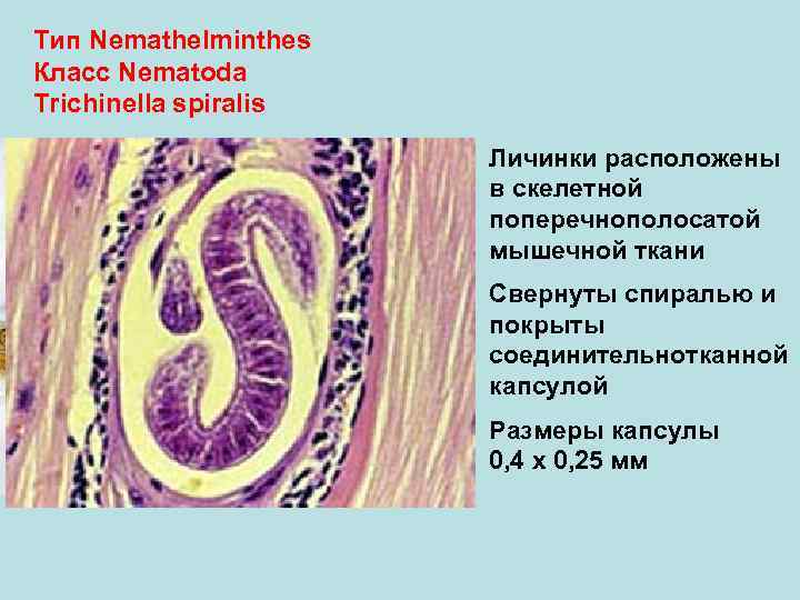 Тип Nemathelminthes Класс Nematoda Trichinella spiralis Личинки расположены в скелетной поперечнополосатой мышечной ткани Свернуты