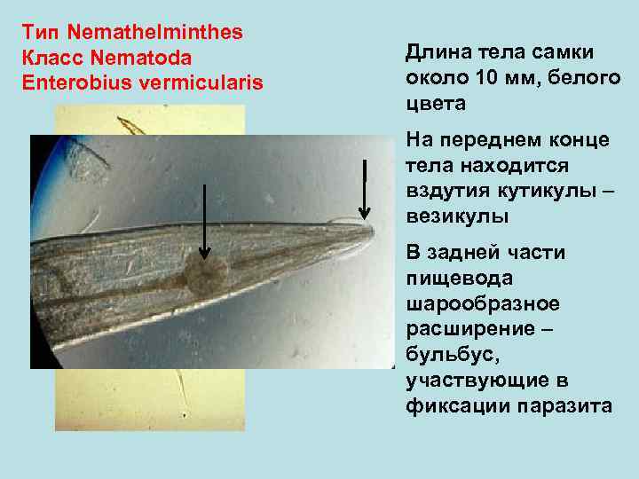 Тип Nemathelminthes Класс Nematoda Enterobius vermicularis Длина тела самки около 10 мм, белого цвета