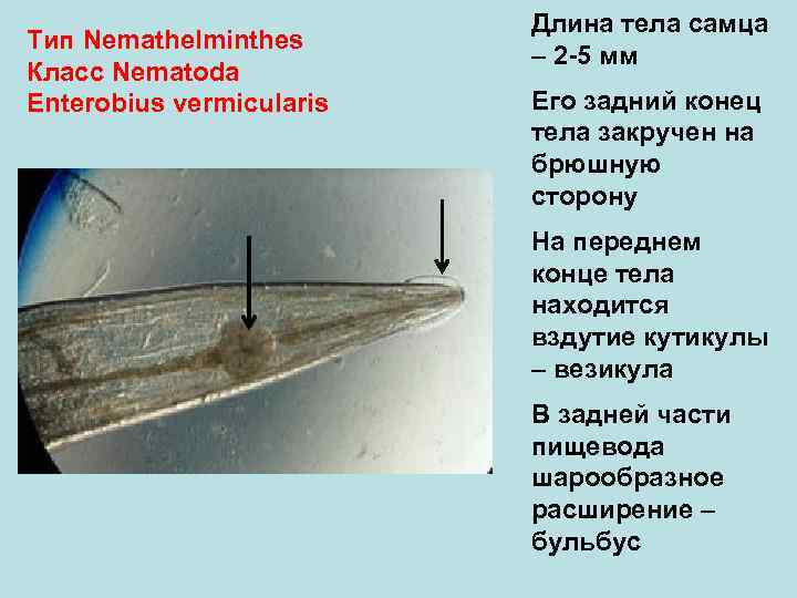 Тип Nemathelminthes Класс Nematoda Enterobius vermicularis Длина тела самца – 2 -5 мм Его