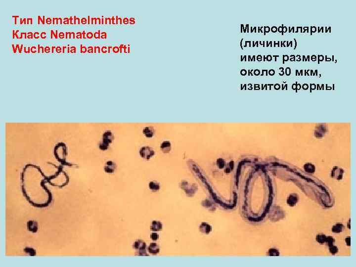 Тип Nemathelminthes Класс Nematoda Wuchereria bancrofti Микрофилярии (личинки) имеют размеры, около 30 мкм, извитой