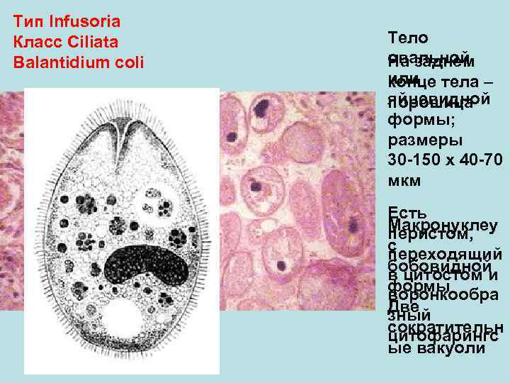 Тип Infusoria Класс Ciliata Balantidium coli Тело овальной На заднем или тела – конце