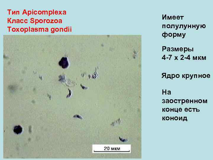 Тип Аpicomplexa Класс Sporozoa Toxoplasma gondii Имеет полулунную форму Размеры 4 -7 х 2