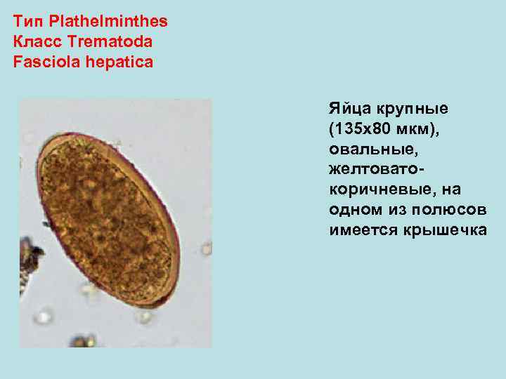 Тип Plathelminthes Класс Trematoda Fasciola hepatica Яйца крупные (135 х80 мкм), овальные, желтоватокоричневые, на